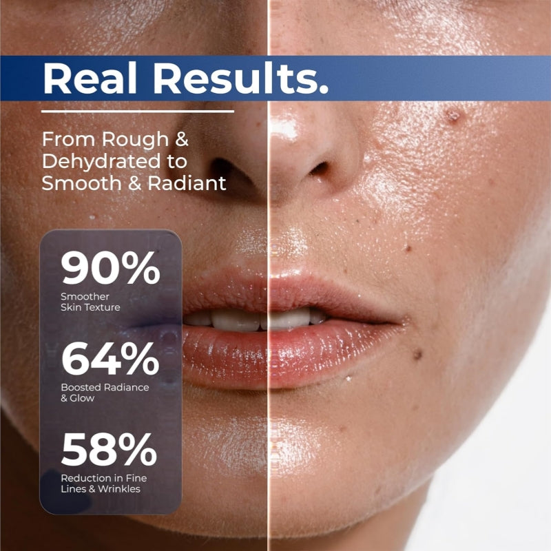 VORLORA® 3% Hyaluronic Acid Ultra Hydrating Serum
