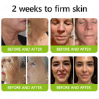 𝑶𝒇𝒇𝒊𝒄𝒊𝒂𝒍 𝑺𝒕𝒐𝒓𝒆👍| Erhalten Sie jugendliche Haut zurück 💫 STDEI® BOTOX & VITA A RETINOL SHOT Faltenstraffende Creme