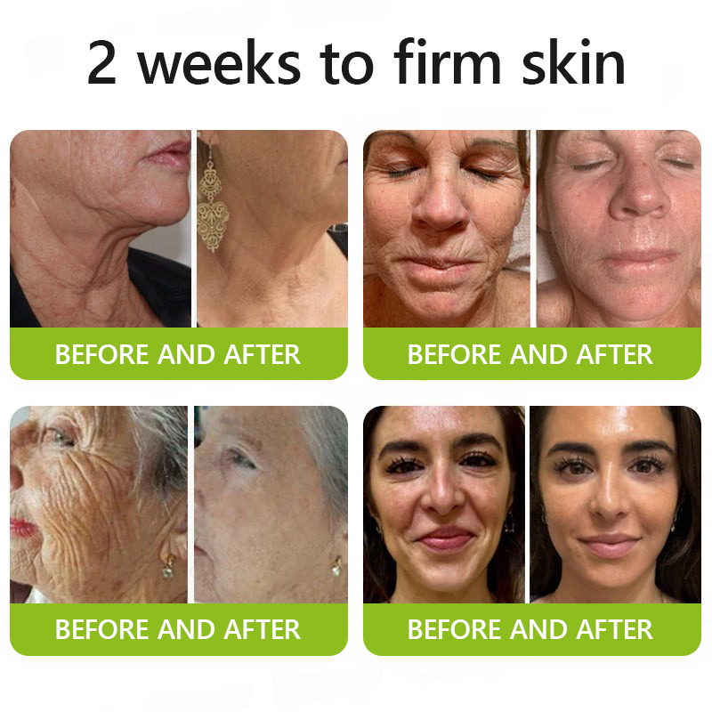 𝑶𝒇𝒇𝒊𝒄𝒊𝒂𝒍 𝑺𝒕𝒐𝒓𝒆👍| Erhalten Sie jugendliche Haut zurück 💫 STDEI® BOTOX & VITA A RETINOL SHOT Faltenstraffende Creme