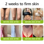 𝑶𝒇𝒇𝒊𝒄𝒊𝒂𝒍 𝑺𝒕𝒐𝒓𝒆👍| Erhalten Sie jugendliche Haut zurück 💫 STDEI® BOTOX & VITA A RETINOL SHOT Faltenstraffende Creme