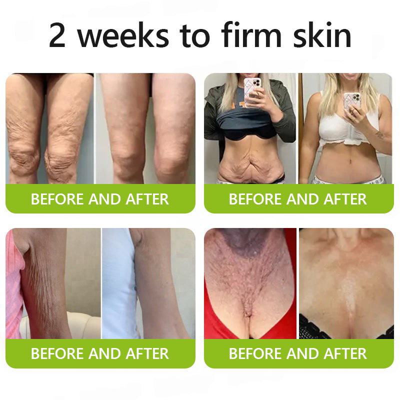 𝑶𝒇𝒇𝒊𝒄𝒊𝒂𝒍 𝑺𝒕𝒐𝒓𝒆👍| Erhalten Sie jugendliche Haut zurück 💫 STDEI® BOTOX & VITA A RETINOL SHOT Faltenstraffende Creme