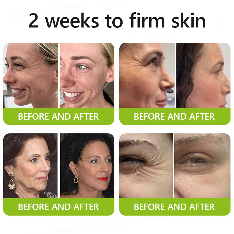 𝑶𝒇𝒇𝒊𝒄𝒊𝒂𝒍 𝑺𝒕𝒐𝒓𝒆👍| Erhalten Sie jugendliche Haut zurück 💫 STDEI® BOTOX & VITA A RETINOL SHOT Faltenstraffende Creme
