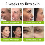 𝑶𝒇𝒇𝒊𝒄𝒊𝒂𝒍 𝑺𝒕𝒐𝒓𝒆👍| Erhalten Sie jugendliche Haut zurück 💫 STDEI® BOTOX & VITA A RETINOL SHOT Faltenstraffende Creme
