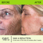 𝑶𝒇𝒇𝒊𝒄𝒊𝒂𝒍 𝑺𝒕𝒐𝒓𝒆👍| Erhalten Sie jugendliche Haut zurück 💫 STDEI® BOTOX & VITA A RETINOL SHOT Faltenstraffende Creme