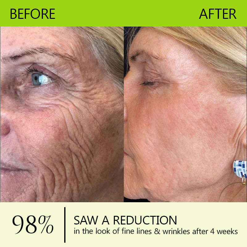 𝑶𝒇𝒇𝒊𝒄𝒊𝒂𝒍 𝑺𝒕𝒐𝒓𝒆👍| Erhalten Sie jugendliche Haut zurück 💫 STDEI® BOTOX & VITA A RETINOL SHOT Faltenstraffende Creme