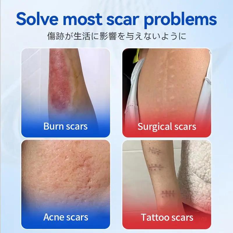 SEALAYEA™  Silicone Scar Gel, Rawatan Parut Jerawat, Boleh Guna Semula