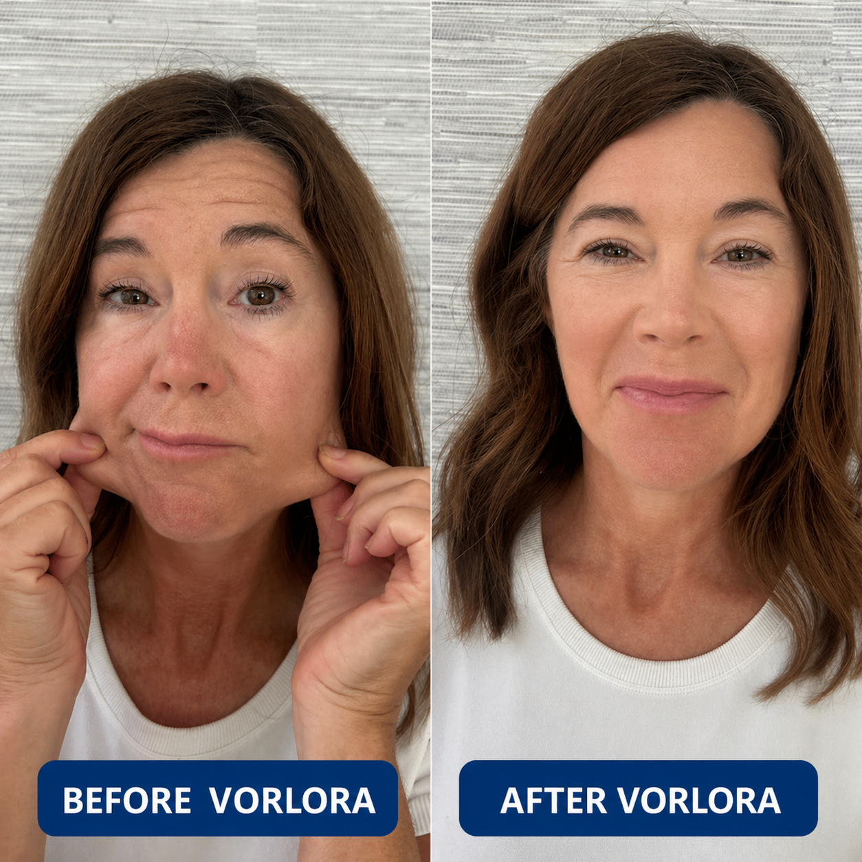 VORLORA® 3% Hyaluronic Acid Ultra Hydrating Serum